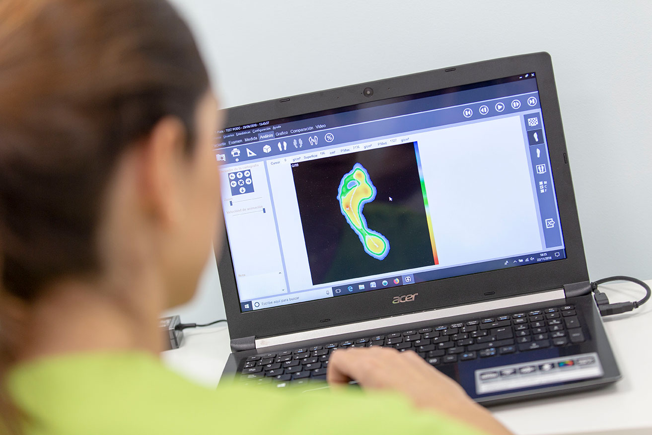 Biomecanica-Estudios-pisada-Plantillas-podobalance